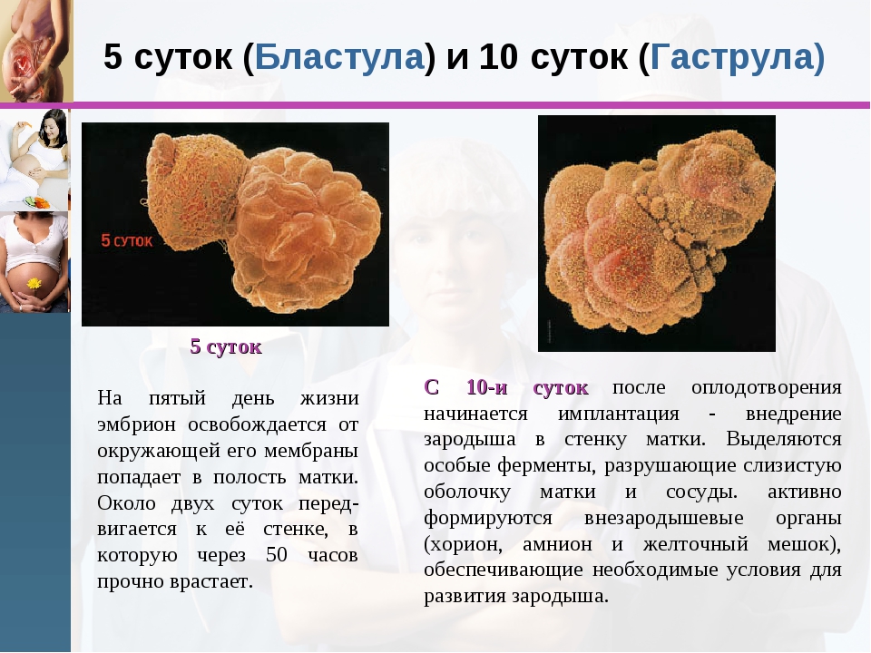 Через сколько эмбрион. Бластула гаструла. Эмбрион на 5 сутки. Как выглядит эмбрион на 5 день.