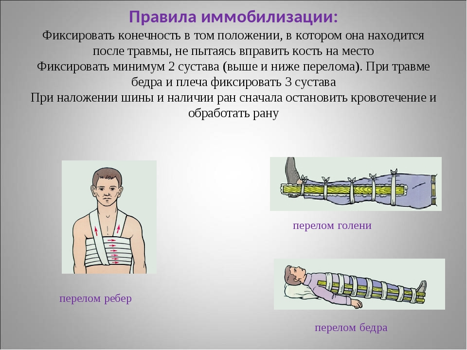 При переломах конечностей накладывается шина ответ