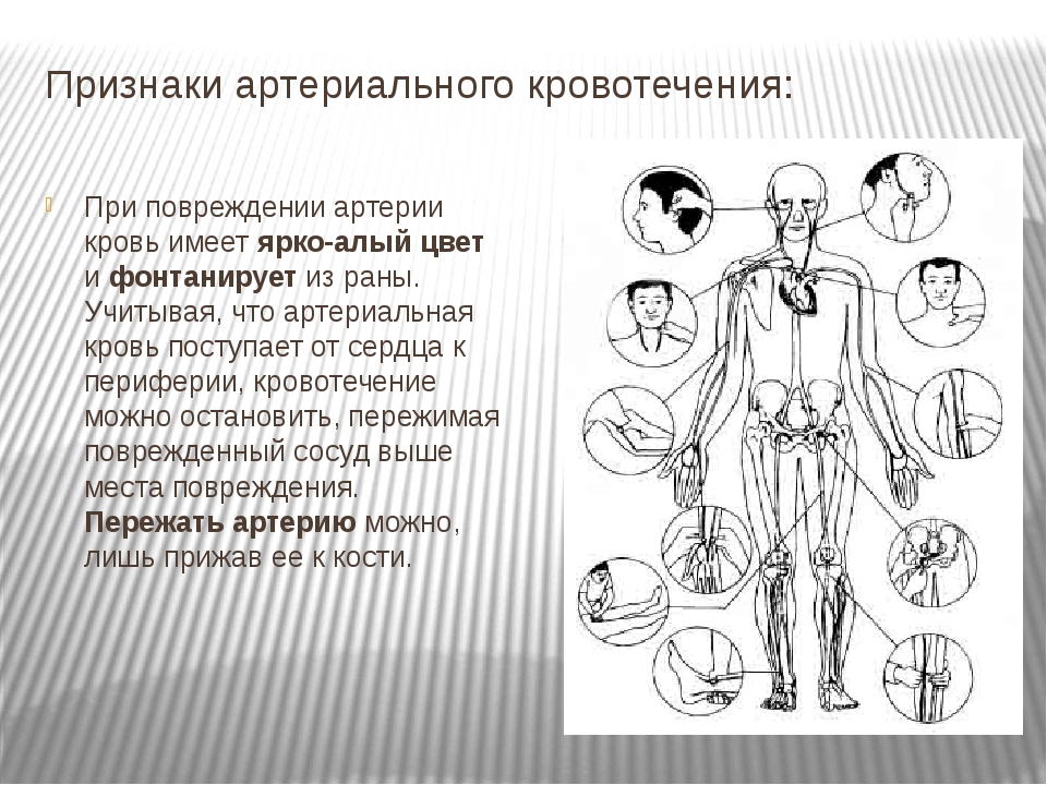 Какой сосуд поврежден на рисунке 1