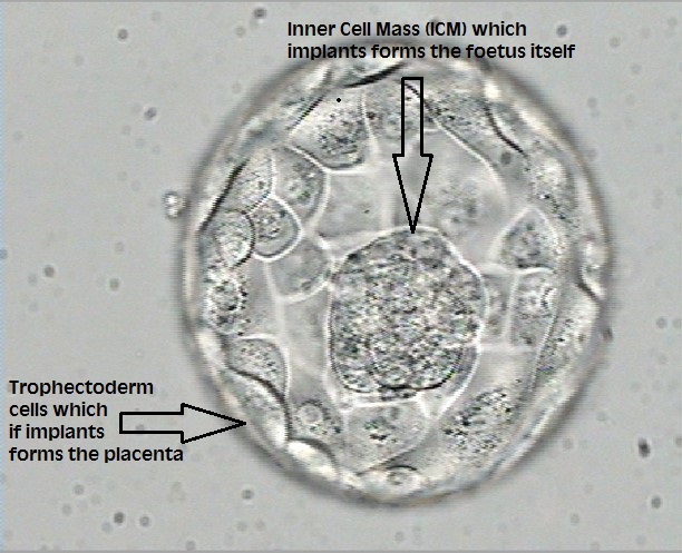 Как выглядит эмбрион 5 дней при эко фото
