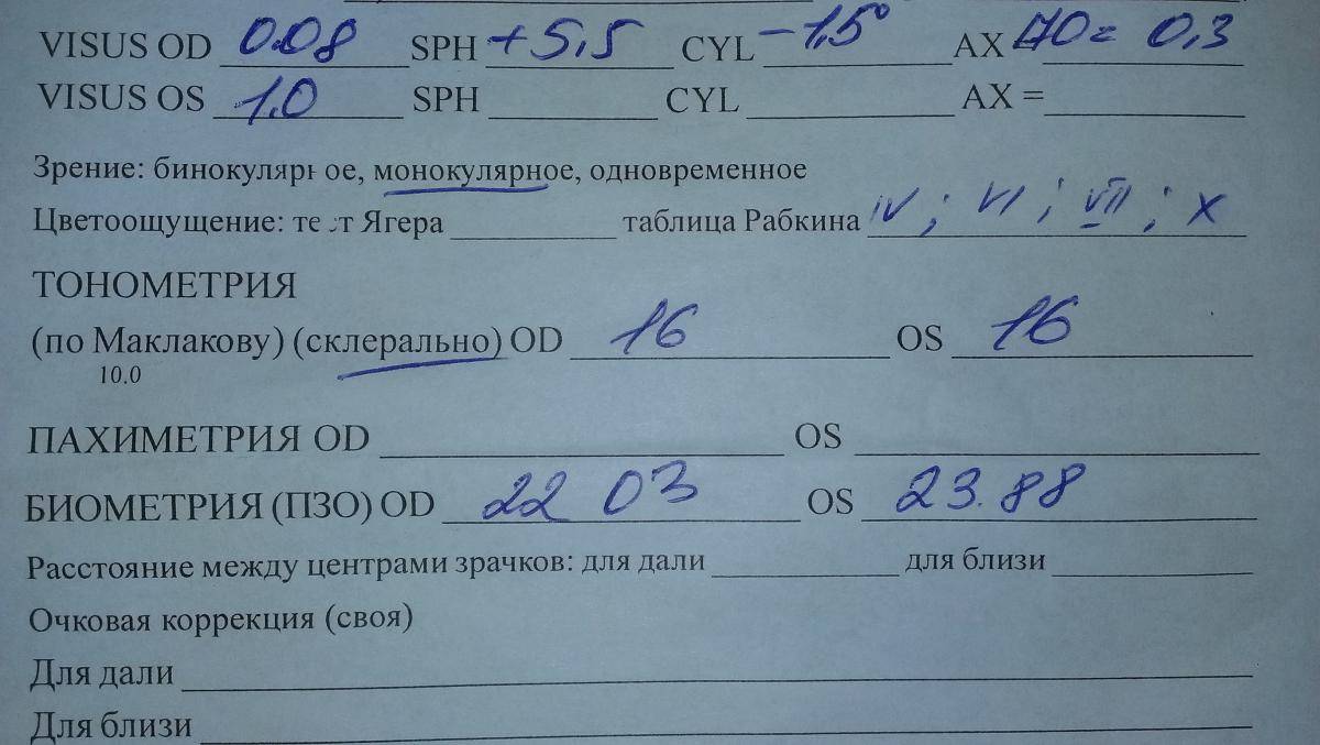 Берут ли со. С каким зрением не берут в армию. Негодность в армию по зрению. Ограничения по зрению в армии. Отклонения по зрению для военкомата.