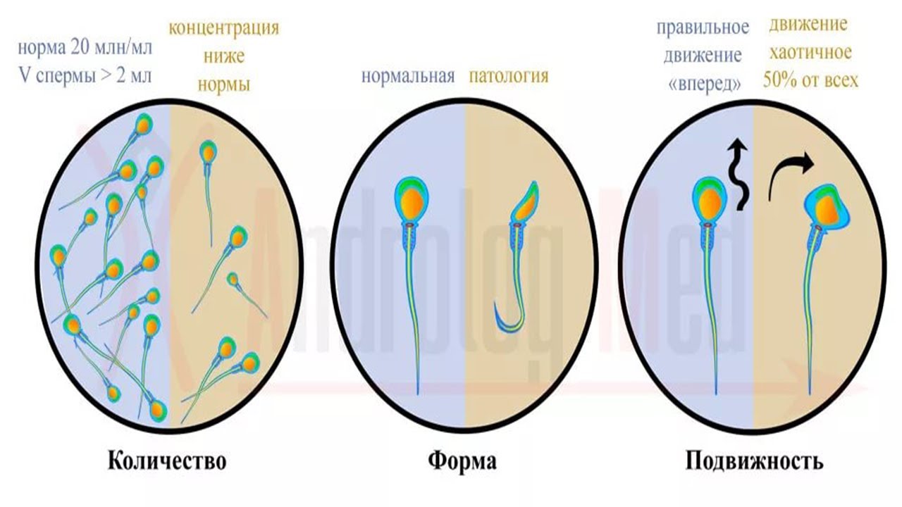 Из Чего Состоит Сперма И Какого Цвета
