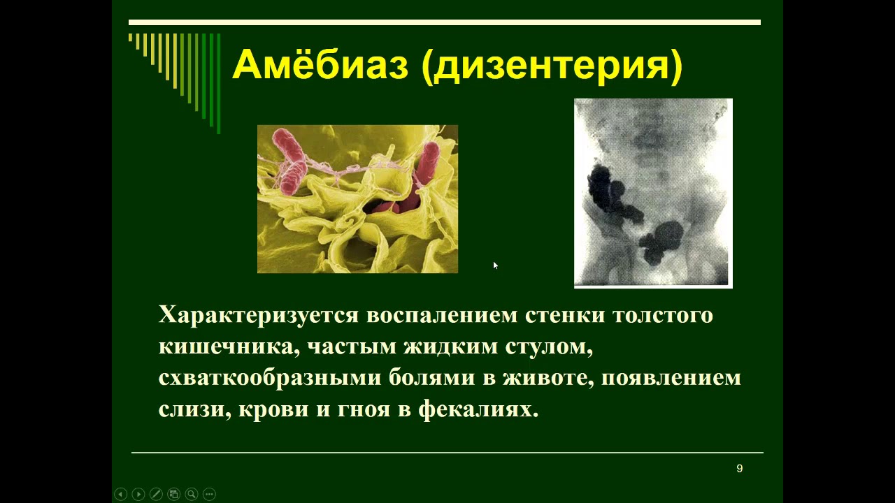 Амебиаз что это такое. Профилактика заболевания амебная дизентерия. Возбудитель болезни амебы дизентерийной. Кишечный амебиаз профилактика. Амебная дизентерия возбудитель заболевания.