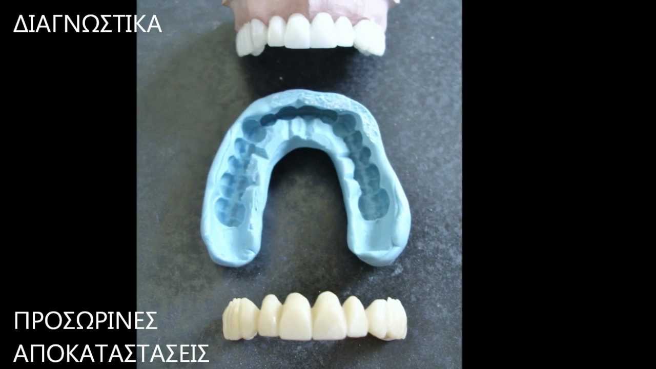 Мокап стоматология. Wax-up технология в стоматологии.