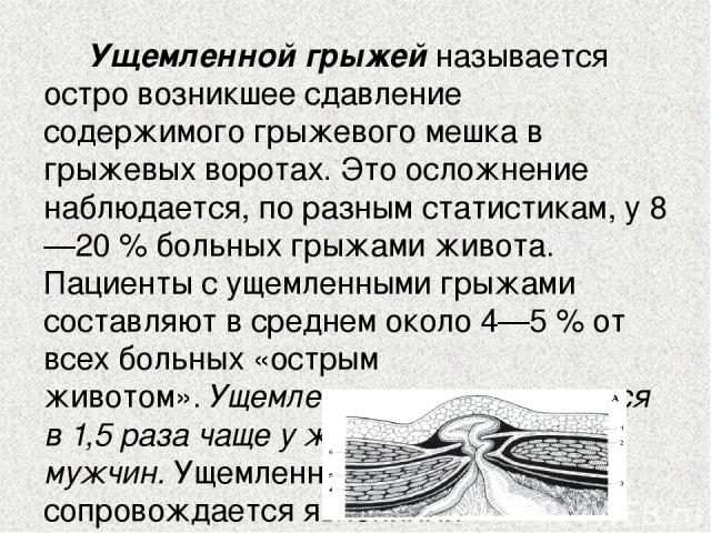 Лечение ущемленной грыжи