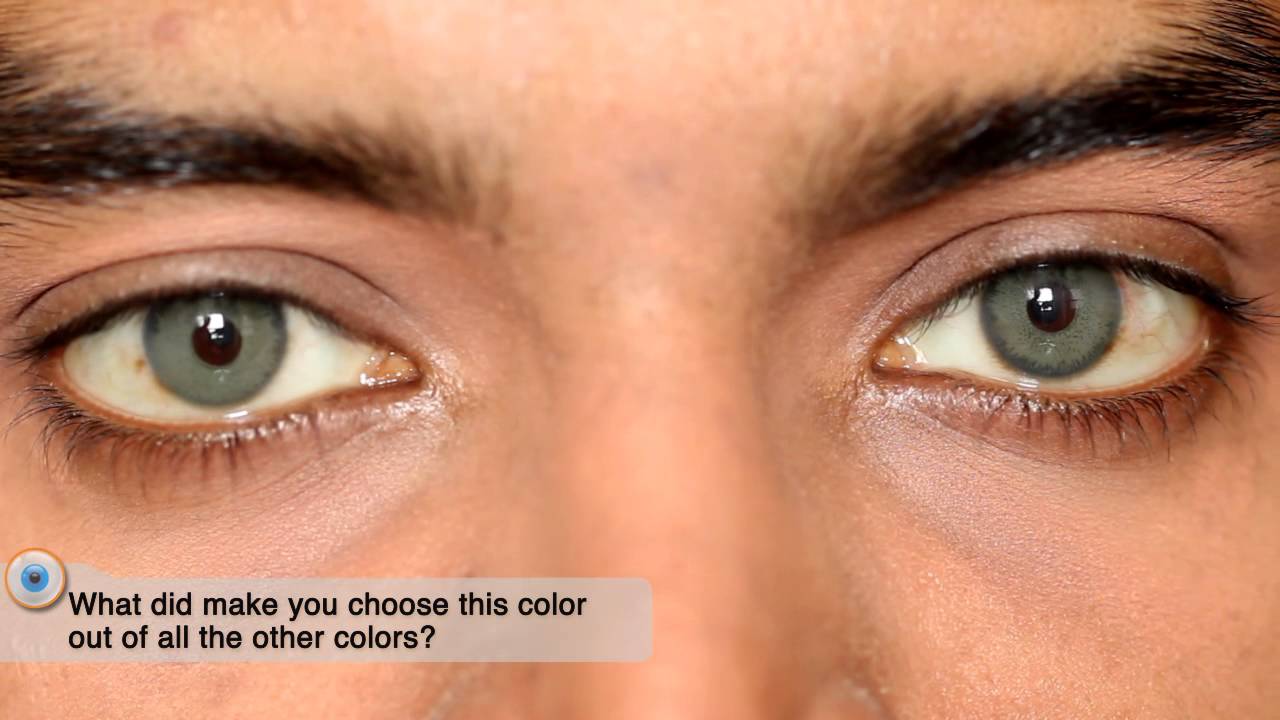 Глаза человека меняют цвет. Изменение цвета глаз. Операция по изменению цвета глаз. Латанопрост изменение цвета глаз. Olive Green Color цвет глаз.