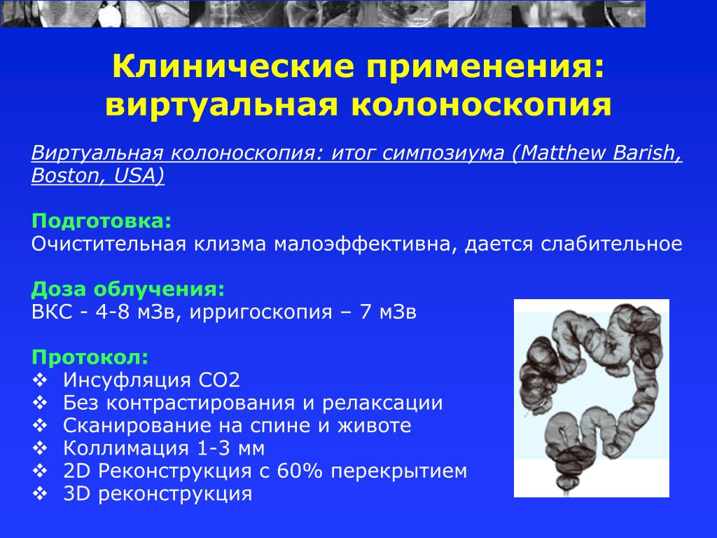 Виртуальная колоноскопия кишечника. Виртуальная колоноскопия. Виртуальная колоноскопия кишечника заключение. Виртуальная кт колоноскопия.