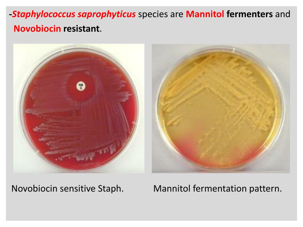 Стафилококк инкубационный. Сапрофитный стафилококк Staphylococcus saprophyticus. Золотистый стафилококк на среде. Классификация стафилококков. Стафилококк сапрофитикус на средах.