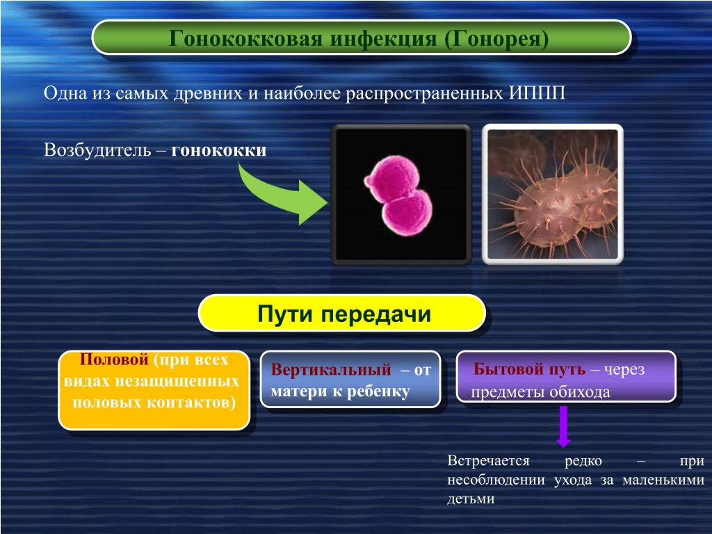 Зппп в картинках