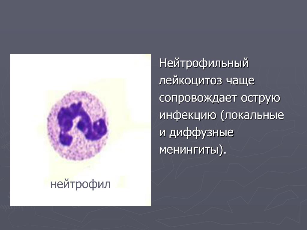 Нейтрофильный лейкоцитоз влево. Лейкоцитоз и нейтрофилия. Нейтрофильные лейкоциты. Лейкоцитоз с нейтрофилезом. Нейтрофильный лейкоцитоз характерен для:.