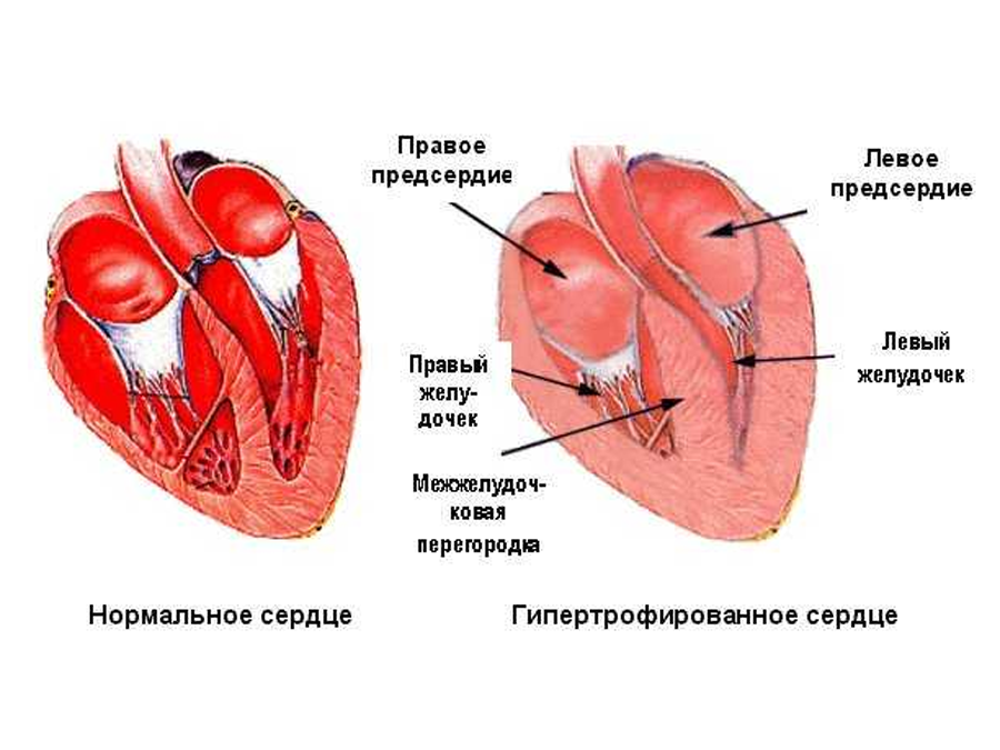 Правое предсердие рисунок