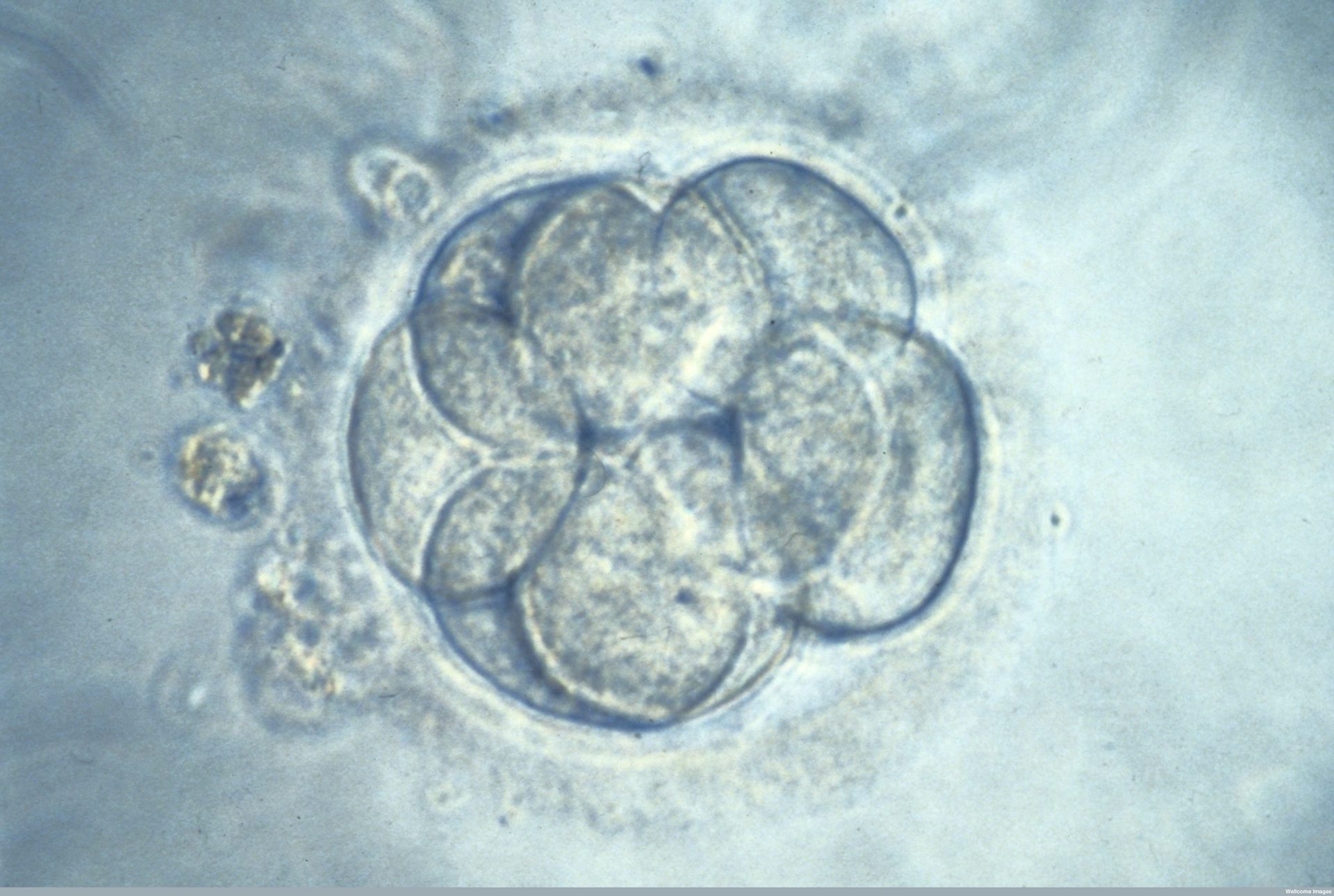 Как выглядит пятидневный эмбрион при эко фото