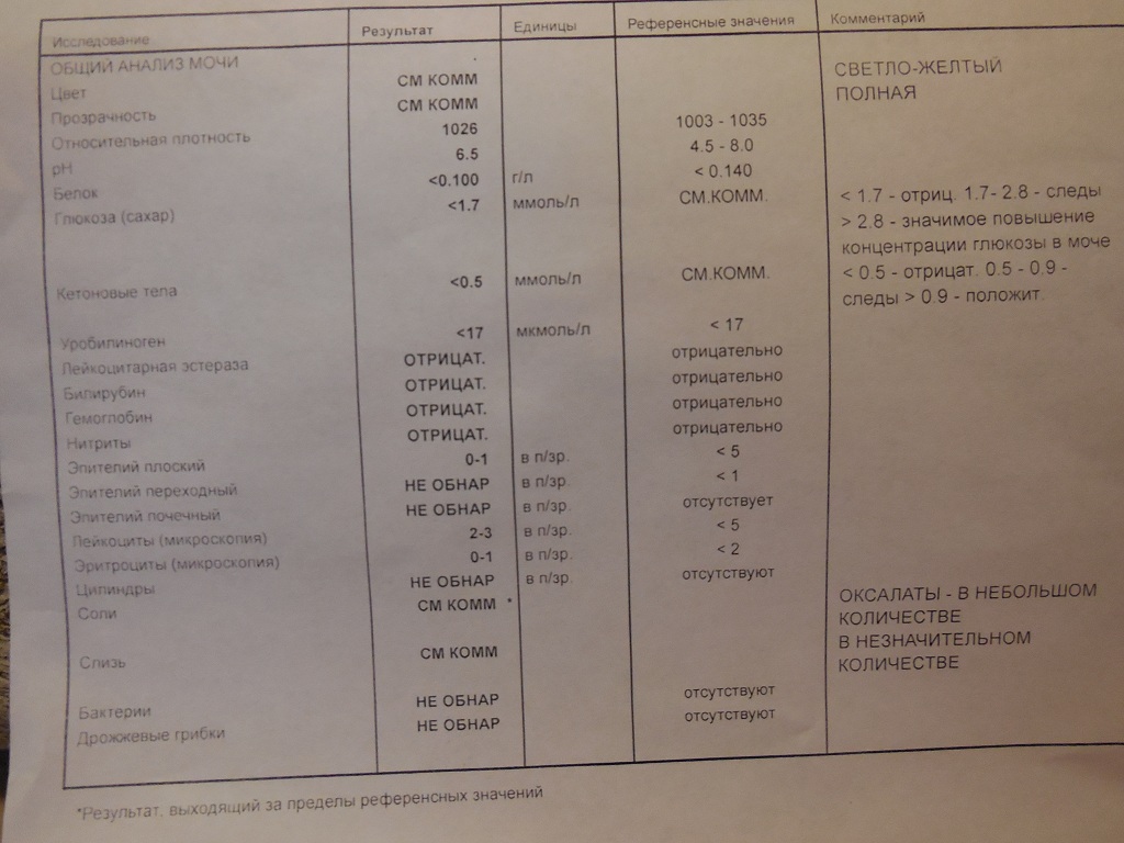 Анализ мочи фото с расшифровкой