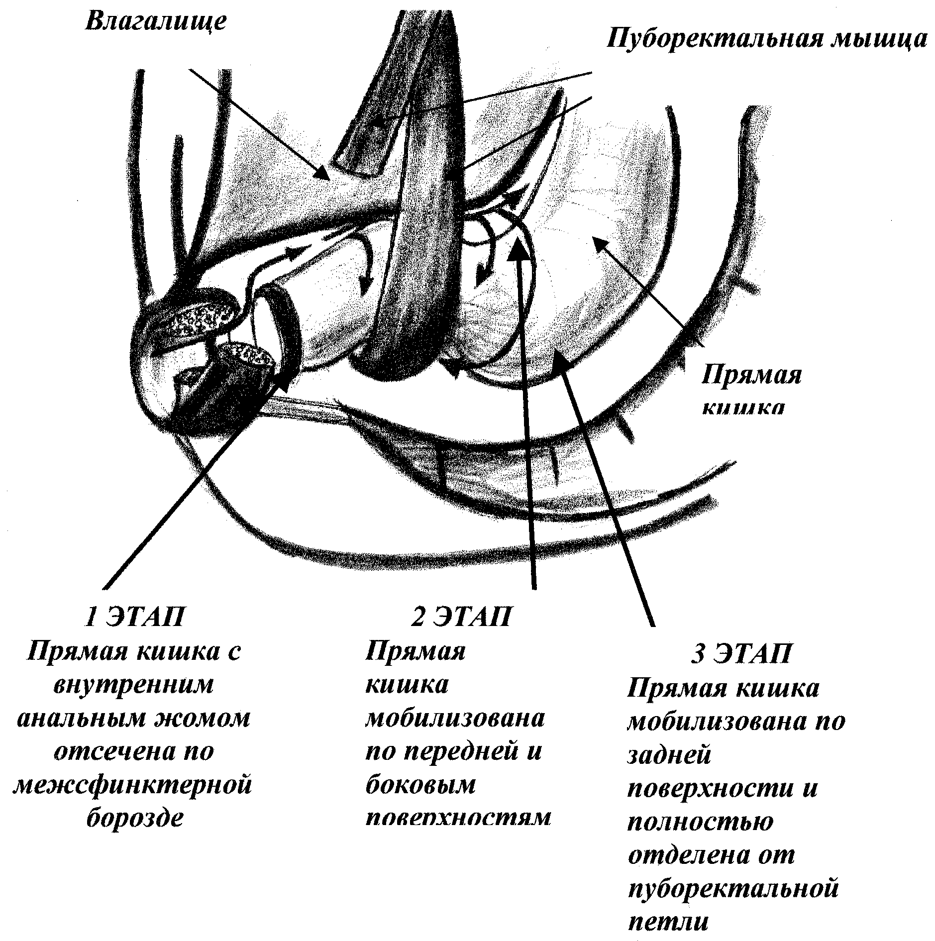 размер члена может принять влагалище фото 80