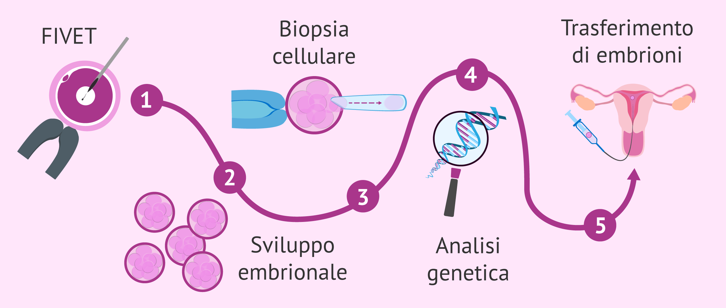 Подсадка эмбриона суррогатной матери. Перенос эмбрионов при эко. Эмбрион при эко. Перенос эмбриона в матку. Экстракорпоральное оплодотворение схема.