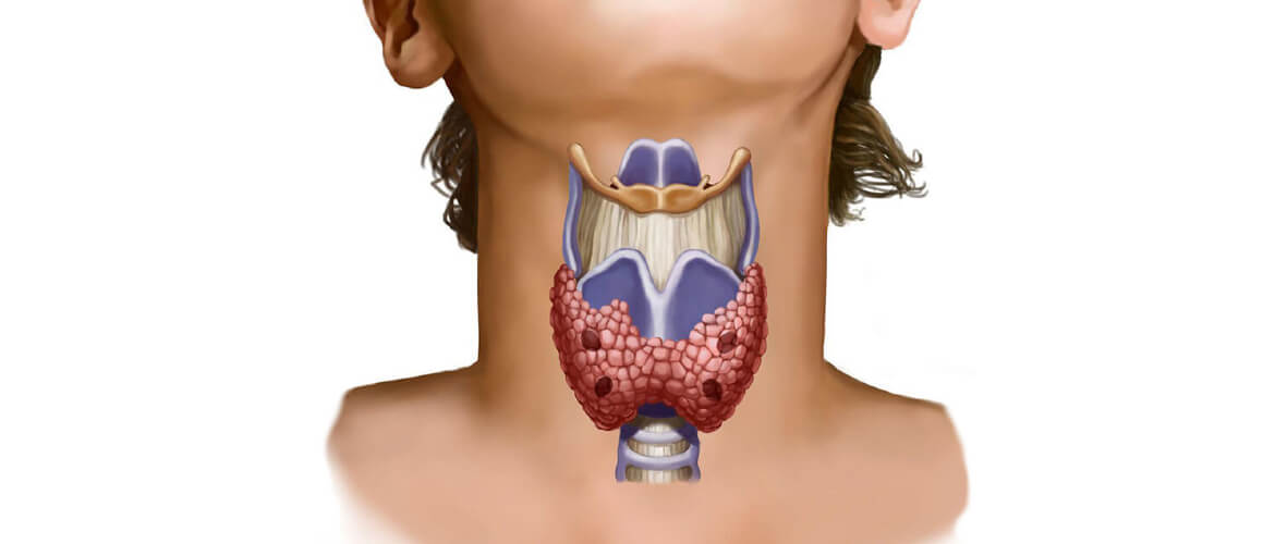 Щитовидная железа и желчный пузырь. Гипотиреоз и гиперплазия щитовидной железы. Гипоплазия щитовидной железы. Щитовидная железа у женщин.