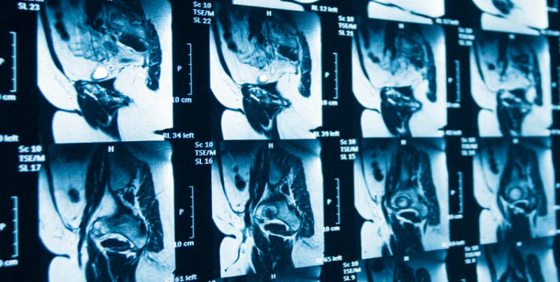 Подготовка к мрт таза. Мрт малого таза Сергея Березина. Магнитно-резонансная томография органов малого таза. Снимки мрт ОМТ. Снимки мрт малого таза.