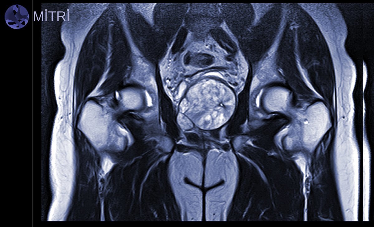 Мрт суставов в москве. Магнитно-резонансная томография тазобедренных суставов. Снимки мрт тазобедренного сустава. Мрт тазобедренного сустава. Мрт таза и тазобедренных суставов.