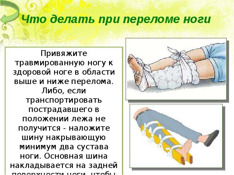 Что делать при переломе. Презентация на тему растяжения травмы и переломы. Первая помощь при переломах вывихах и растяжениях. Растяжение связок первая помощь. Переломы и вывихи кратко.