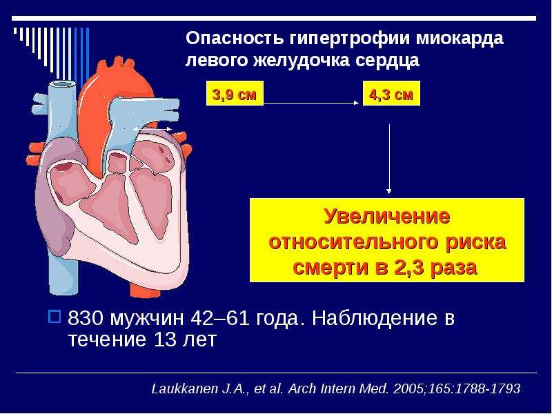 Сколько весит искусственный левый желудочек для сердца. Гипертрофия миокарда левого желудочка сердца что это такое. Гипертрофия желудочка сердца. Причины гипертрофии левого желудочка сердца. Миокарда левого желудочка сердца что это такое.