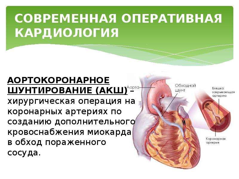 Аортокоронарное шунтирование презентация