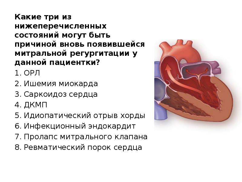 Регургитация на клапане легочной артерии 1
