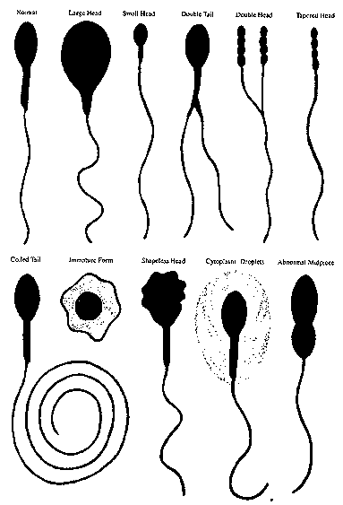 Что будет если кончить в мужчину. Патология сперматозоидов. Патологические сперматозоиды. Как выглядит сперматозоид. Разновидности сперматозоидов.