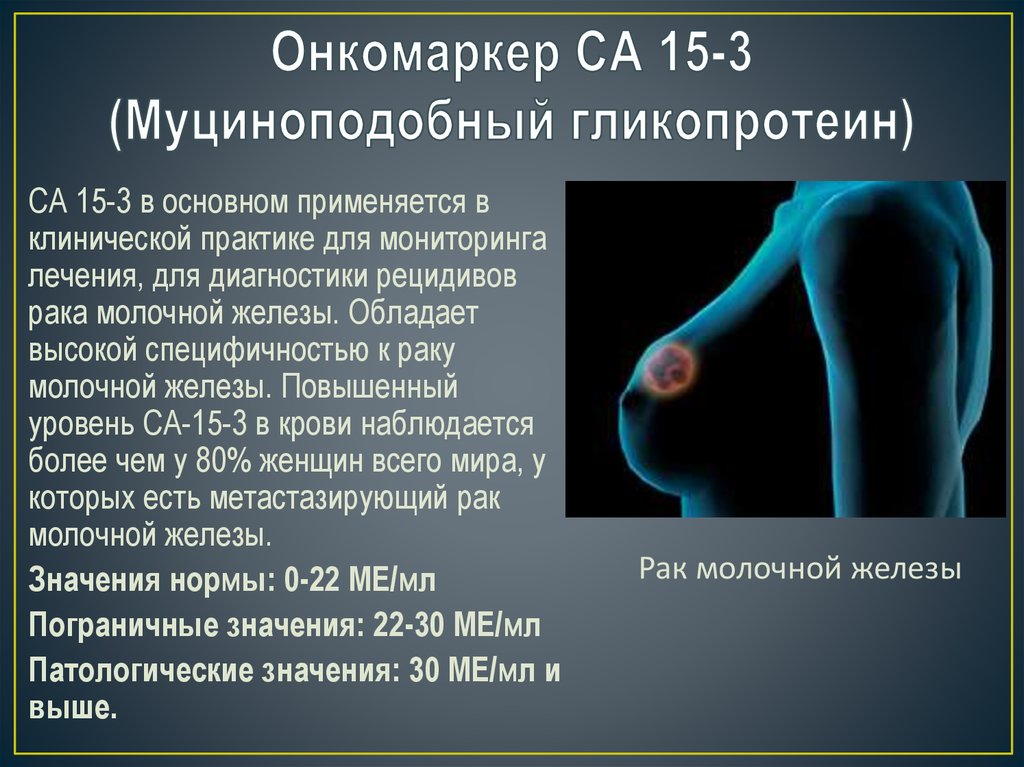 15-3