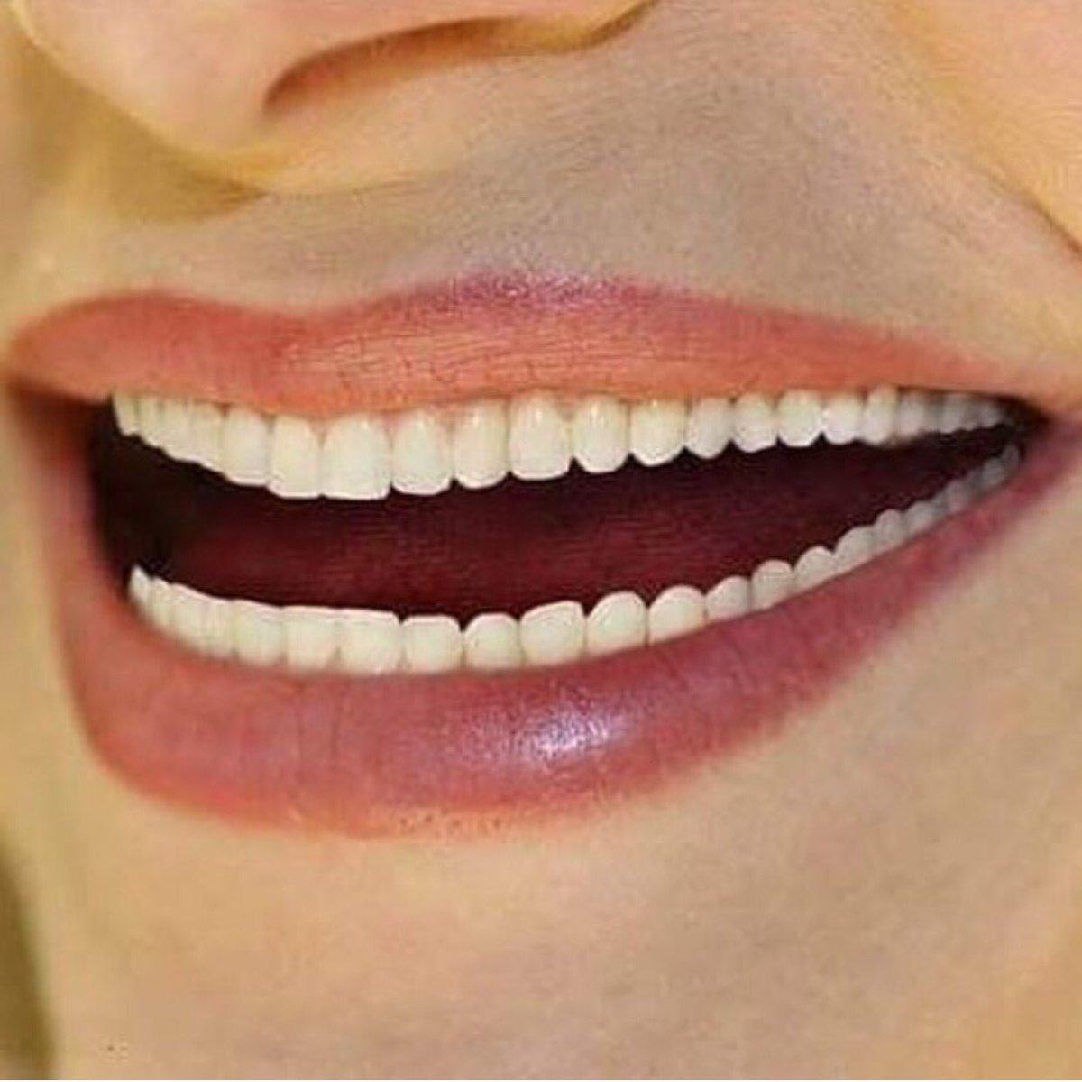 Крупные зубы