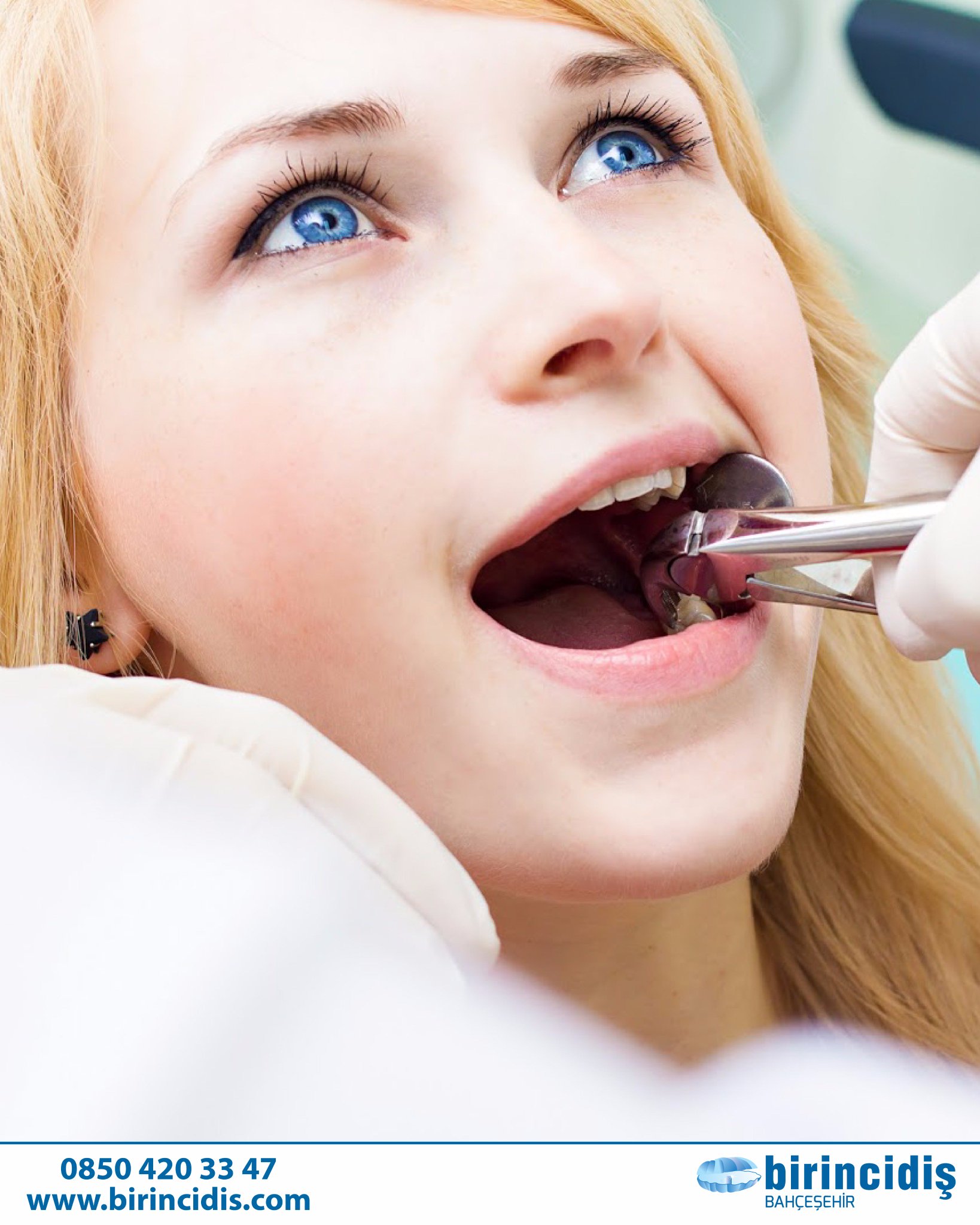 Tooth extraction. Зубы стоматология.