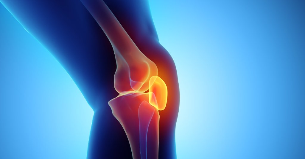 Остеохондрома коленного сустава симптомы и лечение фото