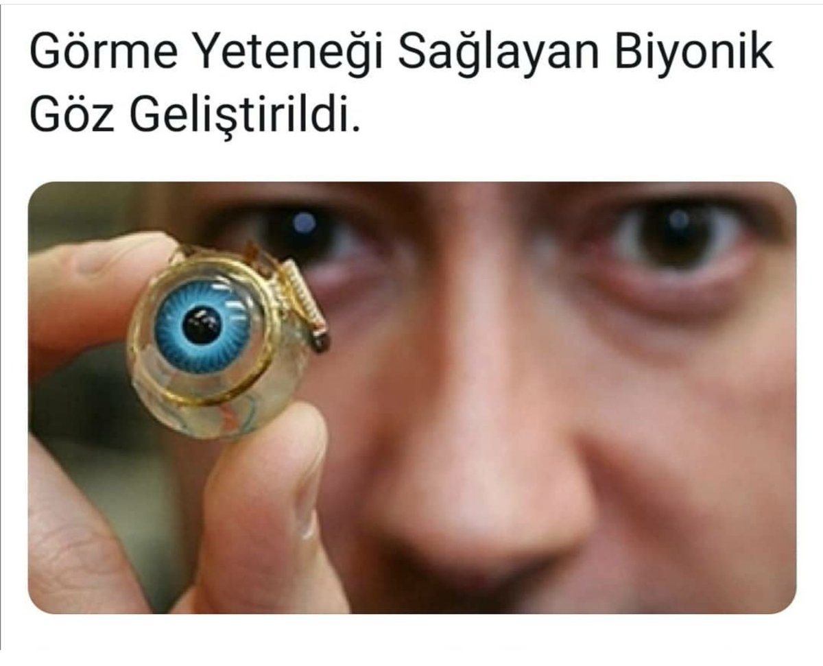 Донор зрение. Аргус 2 бионический глаз. Искусственный глаз для человека. Искусственная сетчатка.