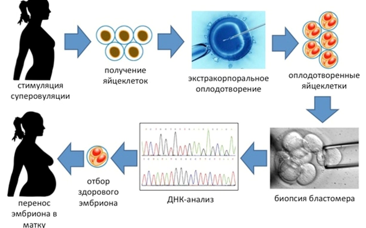 Донорские яйцеклетки москва. Предимплантационная диагностика эмбрионов. Преимплантационная генетическая диагностика. Преимплантационная диагностика наследственных заболеваний. Преимплантационная диагностика проводится.