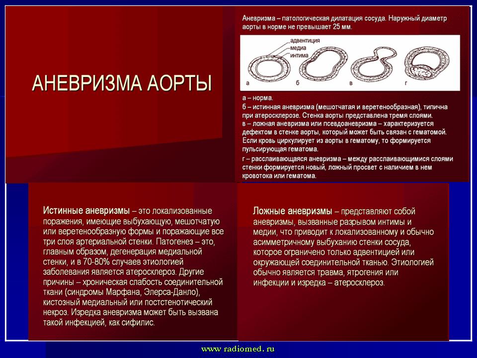 Аневризма аорты узи. Протокол УЗИ аневризмы аорты. Аневризма брюшной аорты УЗИ протокол. Протокол УЗИ аневризмы брюшной аорты. Расслаивающая аневризма брюшной аорты УЗИ протокол.