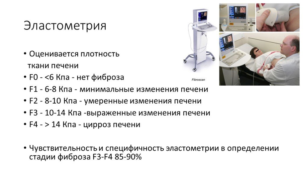 Определение фиброза. Нормальные показатели эластометрии печени. Заключение фиброскан эластометрия печени. Эластография печени норма. Эластография (эластометрия) печени.