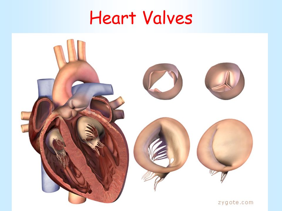 Поражение митрального клапана. Комбинированный сочетанный митральный порок сердца. Приобретенные митральные пороки сердца. Комбинированный митрально-аортальный порок сердца. Комбинированный порок митрального клапана.