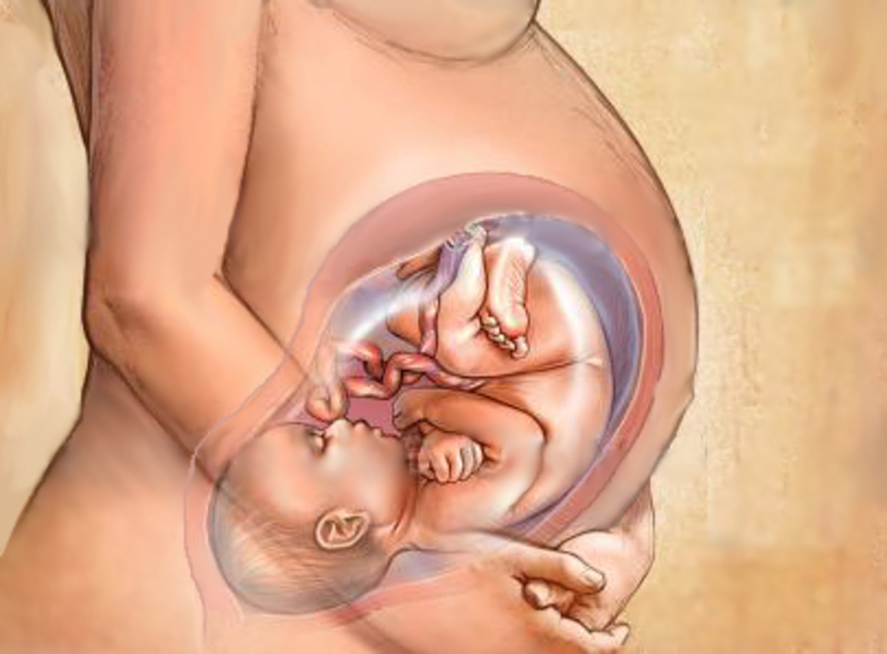 23 неделя беременности жидкость из груди фото 90