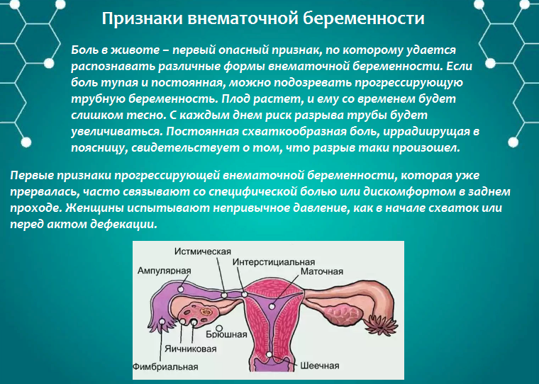 После лечение можно забеременеть. Критерии внематочной беременности. Внематочная беременность на ранних сроках. Беременность эктопическая – внематочная беременность.. Патогенез трубной внематочной беременности.