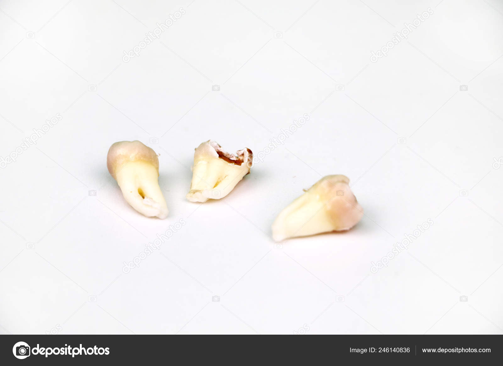 Белый сгусток в лунке удалённого зуба