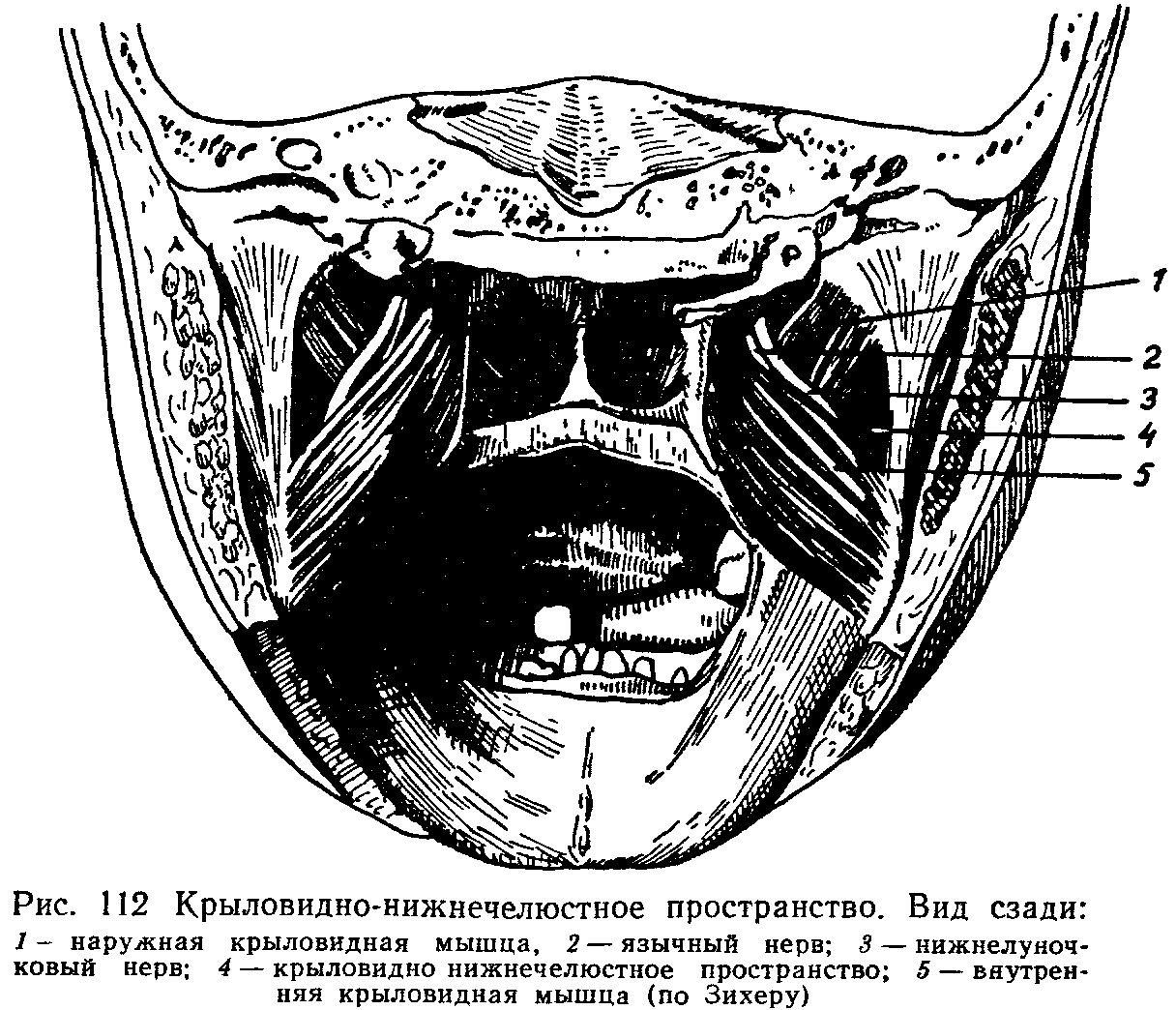 Крыловидно нижнечелюстная складка. Абсцесс крыловидно-нижнечелюстного пространства. Мандибулярная анестезия анатомия. Крыловидно нижнечелюстное пространство топографическая анатомия. Крыловидно-нижнечелюстной шов анатомия.