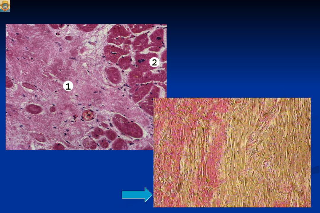 Cardiosclerosis латынь