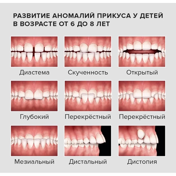 Как правильно смыкаются зубы картинка