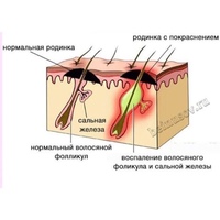 Карта родинок спб