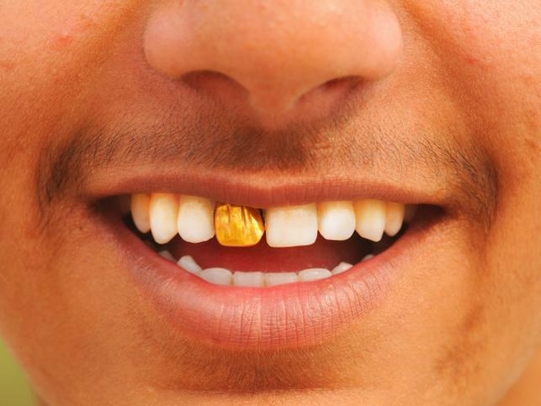 Улыбка с желтыми зубами фото