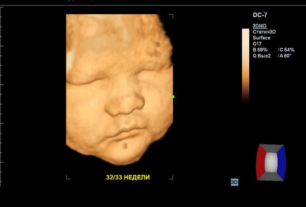 4d узи беременности. 3д УЗИ В Перми беременности. Трехмерное УЗИ при беременности.