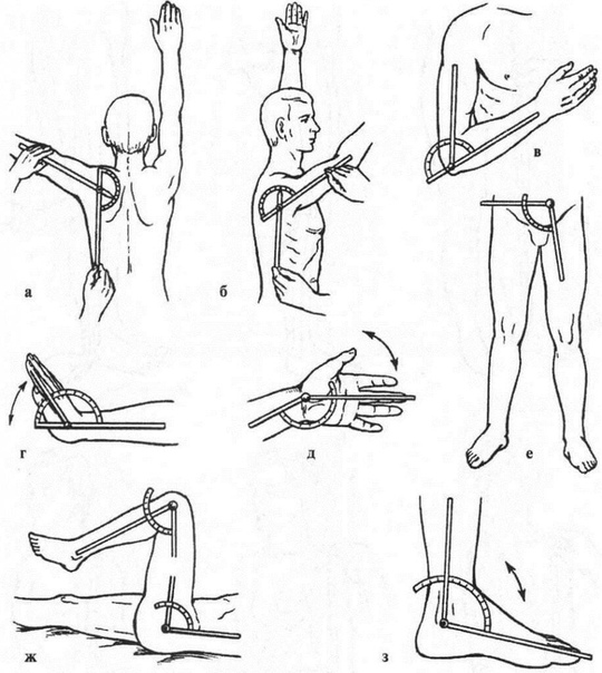 Схема движения суставов. Измерение амплитуды движений в суставах. Измерение амплитуды движений в суставах угломером. Гониометрия локтевого сустава. Контрактура тазобедренного сустава.
