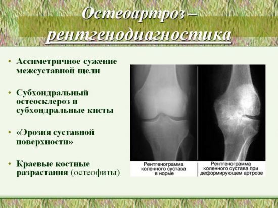 Рентген кости