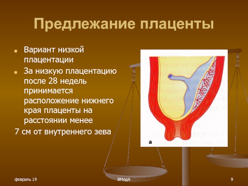 Плацента внутренний зев