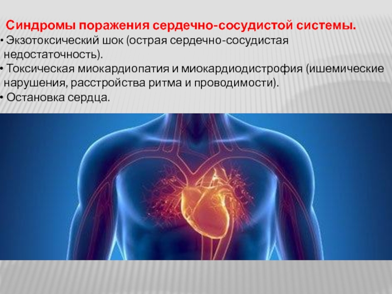 Сердечная сосудистая недостаточность шок. Синдромы поражения сердечно-сосудистой системы. Сердечно сосудистый синдром. Синдромы при сердечно сосудистых заболеваниях. Токсическое поражение сердца.