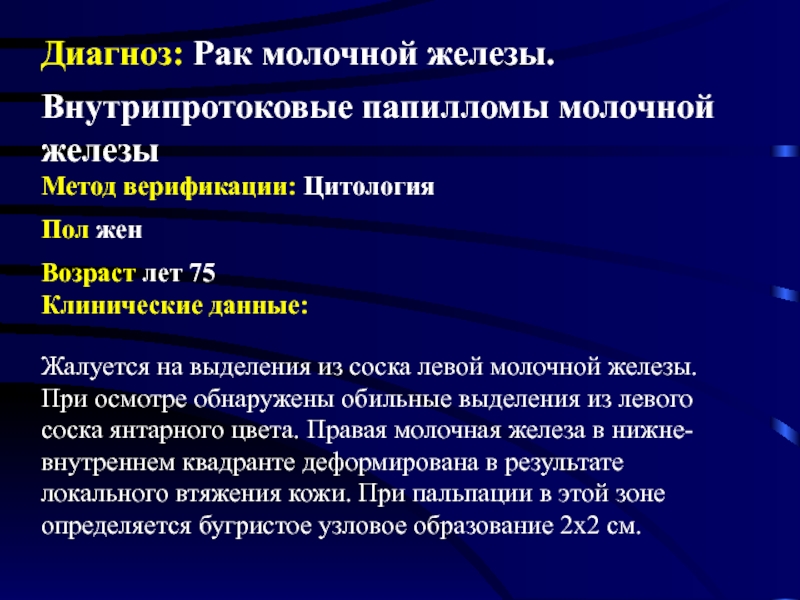 Диагноз д есть. Диагнозы молочной железы. Диагноз в1 молочной железы что это. Диагноз Susp CA молочной железы. Что такое диагноз молочной железы 50.4.